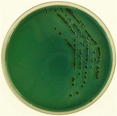 green colonies on tcbs agar